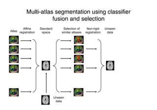 Multi-atlas segmentation using classiﬁer
fusion and selection
Atlas
Affine
registration
Standard
space
Selection of
similar atlases
Non-rigid
registration
X
X
Unseen
data
Unseen
data
 