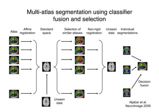 Multi-atlas segmentation using classiﬁer
fusion and selection
Atlas
Affine
registration
Standard
space
Selection of
similar atlases
Non-rigid
registration
X
X
Unseen
data
Individual
segmentations
Decision
fusion
Unseen
data Aljabar et al.
NeuroImage 2009
 