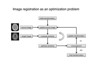 Image registration as an optimization problem
 