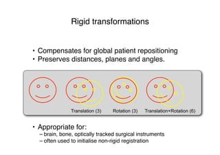 Rigid transformations
• Compensates for global patient repositioning
• Preserves distances, planes and angles.
• Appropriate for:
– brain, bone, optically tracked surgical instruments
– often used to initialise non-rigid registration
Translation (3) Translation+Rotation (6)Rotation (3)
 