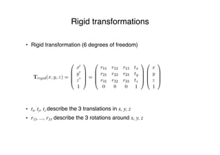 Rigid transformations
• Rigid transformation (6 degrees of freedom)
• tx, ty, tz describe the 3 translations in x, y, z
• r11, ..., r33 describe the 3 rotations around x, y, z
 