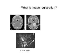 What is image registration?
C. Ruff, 1995
 