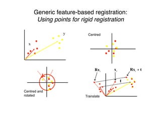 Generic feature-based registration:
Using points for rigid registration
Centred
Centred and
rotated
t
iRx ix tRx +i
Translate
x
y
 