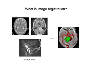 What is image registration?
C. Ruff, 1995
 