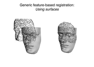 Generic feature-based registration:
Using surfaces
 
