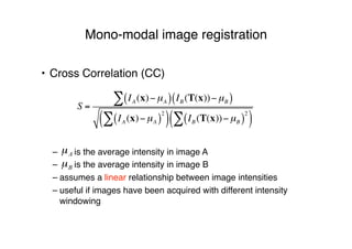 Mono-modal image registration
• Cross Correlation (CC)
– is the average intensity in image A
– is the average intensity in image B
– assumes a linear relationship between image intensities
– useful if images have been acquired with different intensity
windowing
Aµ
Bµ
S =
IA (x)!µA( ) IB (T(x))!µB( )"
IA (x)!µA( )
2
"( ) IB (T(x))!µB( )
2
"( )
 