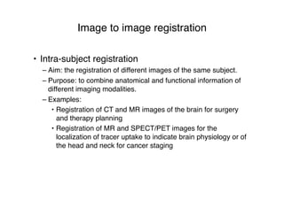 Image to image registration
• Intra-subject registration
– Aim: the registration of different images of the same subject.
– Purpose: to combine anatomical and functional information of
different imaging modalities.
– Examples:
• Registration of CT and MR images of the brain for surgery
and therapy planning
• Registration of MR and SPECT/PET images for the
localization of tracer uptake to indicate brain physiology or of
the head and neck for cancer staging
 