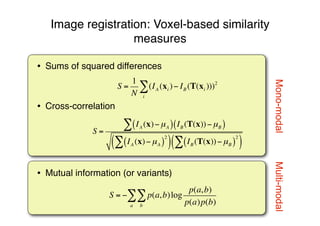 Multi-modalMono-modal
• Sums of squared differences
• Cross-correlation
• Mutual information (or variants)
Image registration: Voxel-based similarity
measures
S =
1
N
(IA (xi )
i
! " IB (T(xi )))2
S =
IA (x)!µA( ) IB (T(x))!µB( )"
IA (x)!µA( )
2
"( ) IB (T(x))!µB( )
2
"( )
S = ! p(a,b)log
p(a,b)
p(a)p(b)b
"
a
"
 