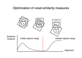 Optimization of voxel-similarity measures
Similarity
measure
Alignment
inside capture range outside capture range
 