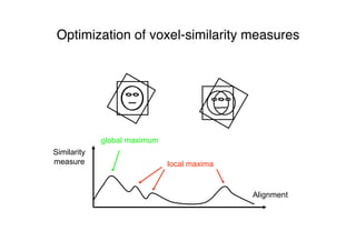Similarity
measure
Alignment
local maxima
global maximum
Optimization of voxel-similarity measures
 