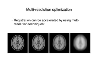 Multi-resolution optimization
• Registration can be accelerated by using multi-
resolution techniques:
 
