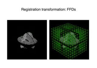 Registration transformation: FFDs
 