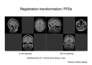 Registration transformation: FFDs
5 mm spacing 20 mm spacing
Displacement of 1 control point along 1 axis
Thanks to Marc Modat
 