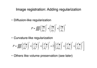 Image registration: Adding regularization
• Diffusion-like regularization
• Curvature-like regularization
• Others like volume preservation (see later)
P =
!u
!x
"
#
$
%
&
'
2
+
!u
!y
"
#
$
%
&
'
2
+
!u
!z
"
#
$
%
&
'
2
(((
P =
!2
u
!x2
"
#
$
%
&
'
2
+
!2
u
!y2
"
#
$
%
&
'
2
+
!2
u
!z2
"
#
$
%
&
'
2
+ 2
!2
u
!xy
"
#
$
%
&
'
2
+
!2
u
!xz
"
#
$
%
&
'
2
+
!2
u
!yz
"
#
$
%
&
'
2(
)
*
*
+
,
-
-
...
 