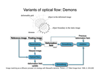 Variants of optical ﬂow: Demons
Image matching as a diffusion process: an analogy with Maxwell's demons. Thirion, J. P. Med Image Anal, 1998, 2, 243-260
 