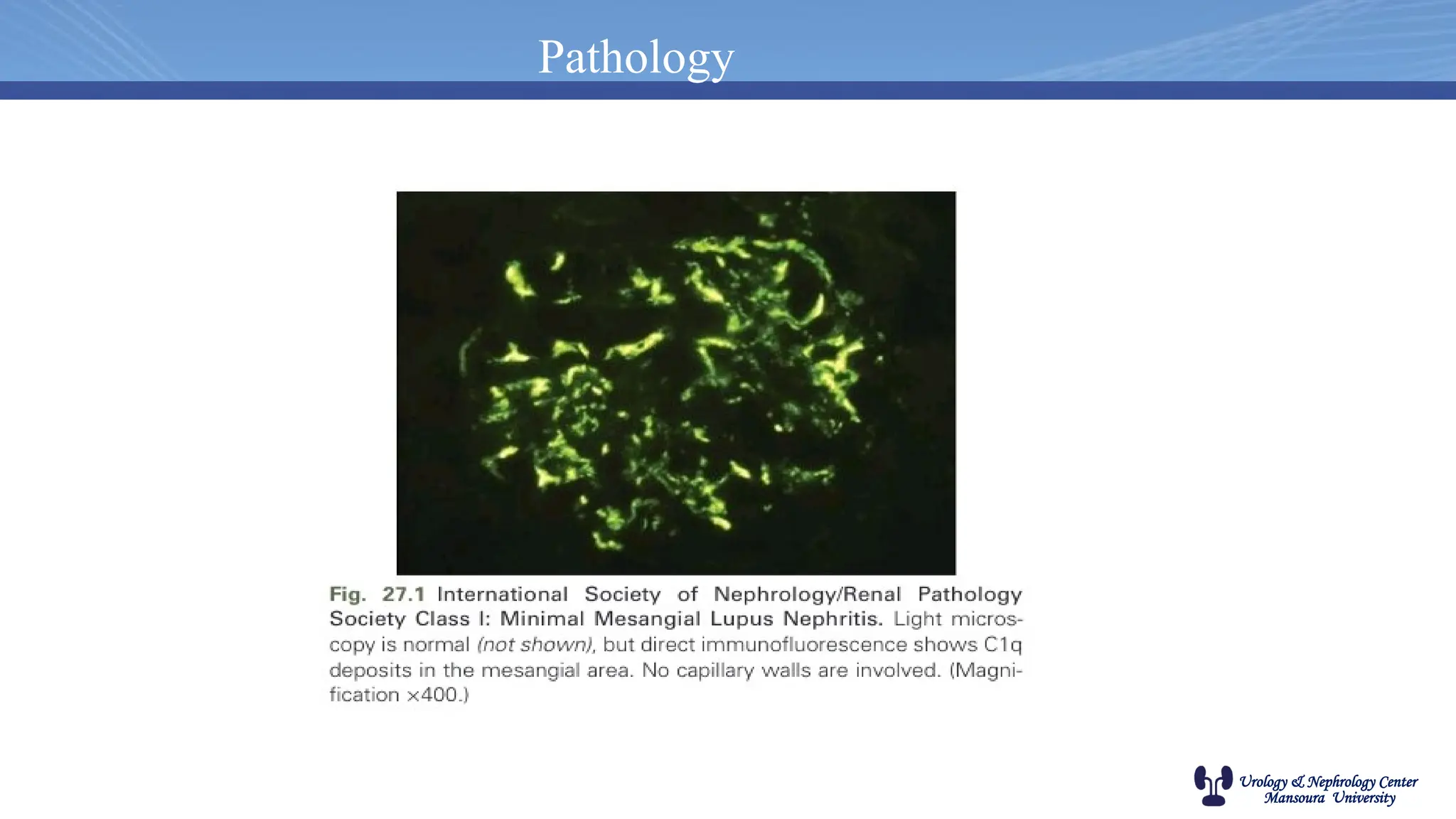 Urology & Nephrology Center
Mansoura University
Pathology
 