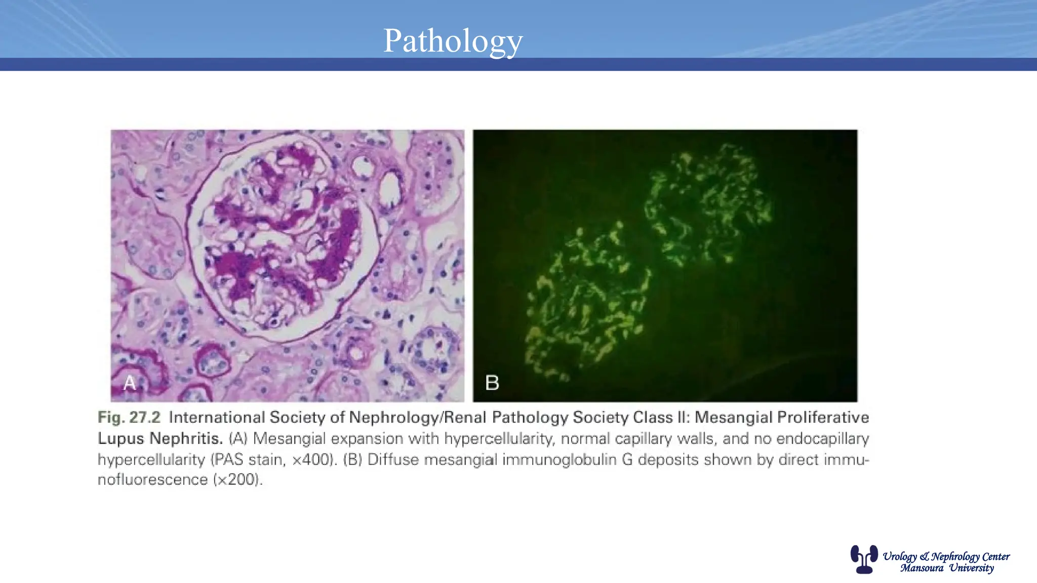 Urology & Nephrology Center
Mansoura University
Pathology
 