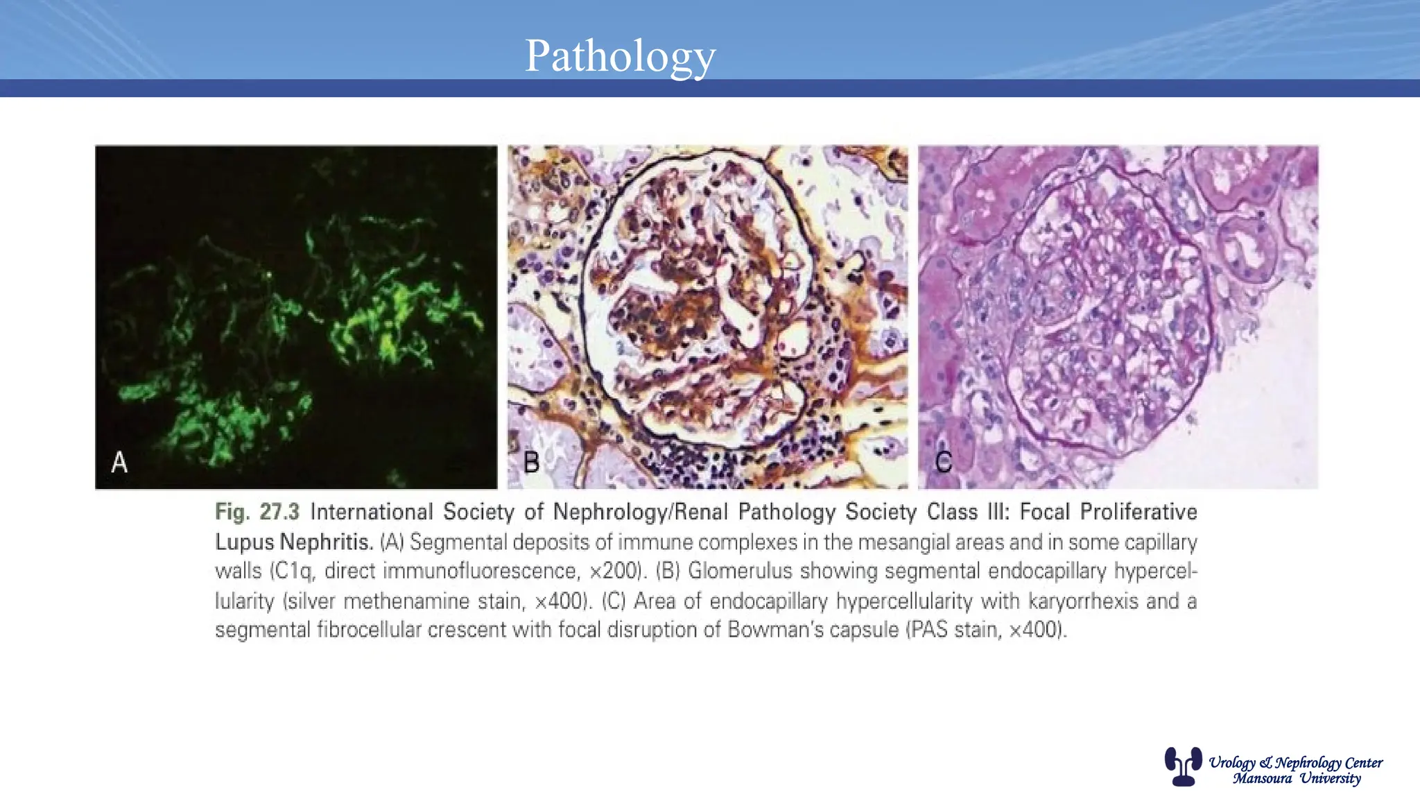Urology & Nephrology Center
Mansoura University
Pathology
 