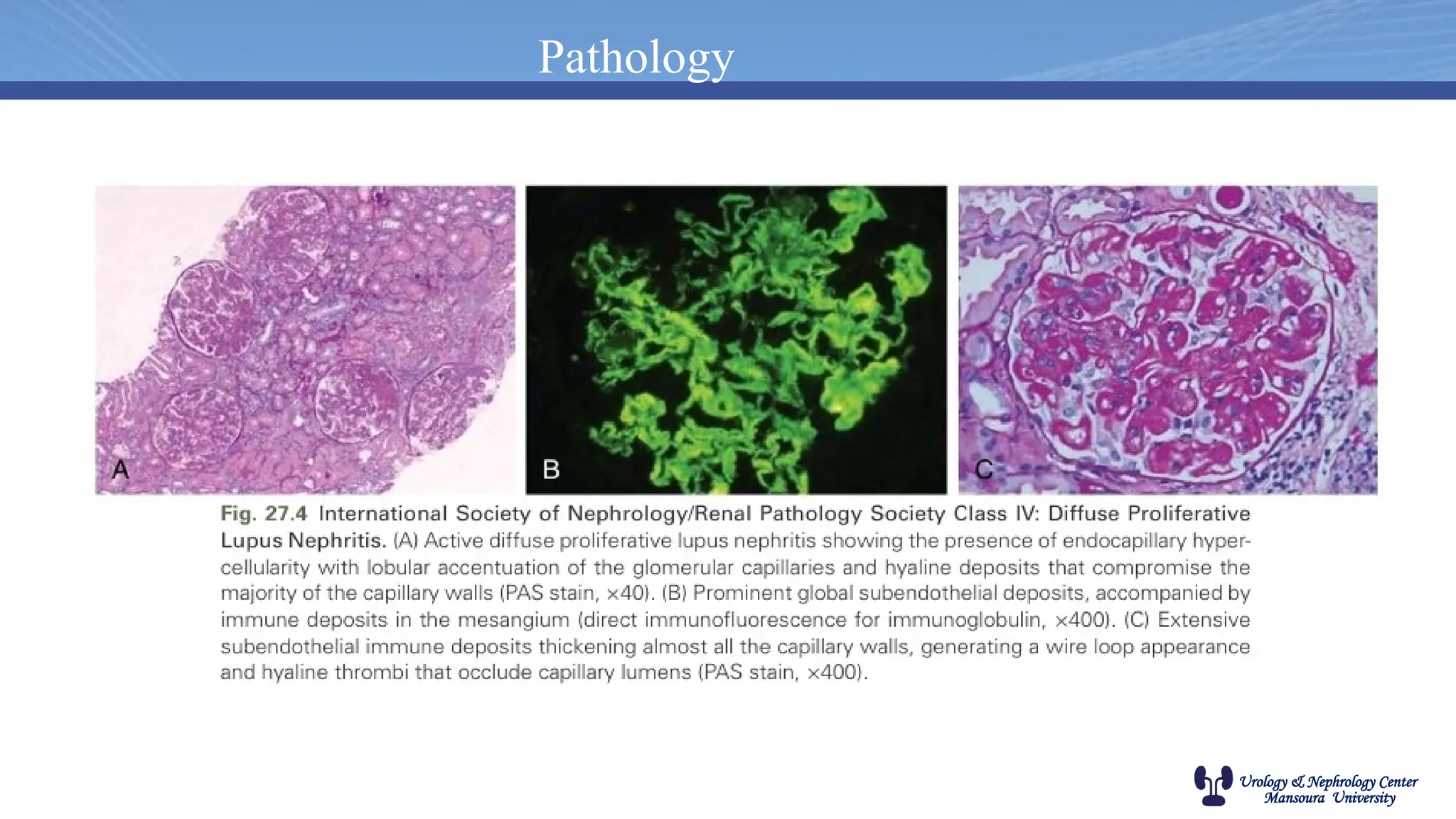 Urology & Nephrology Center
Mansoura University
Pathology
 