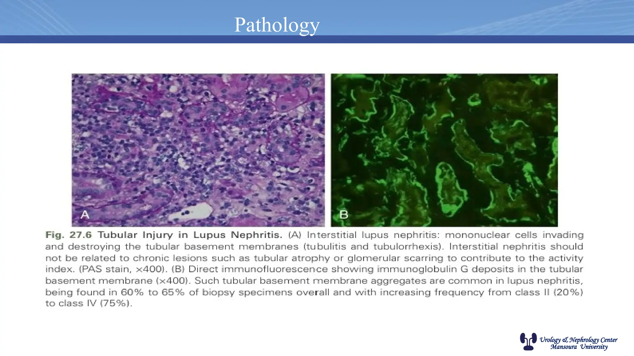 Urology & Nephrology Center
Mansoura University
Pathology
 