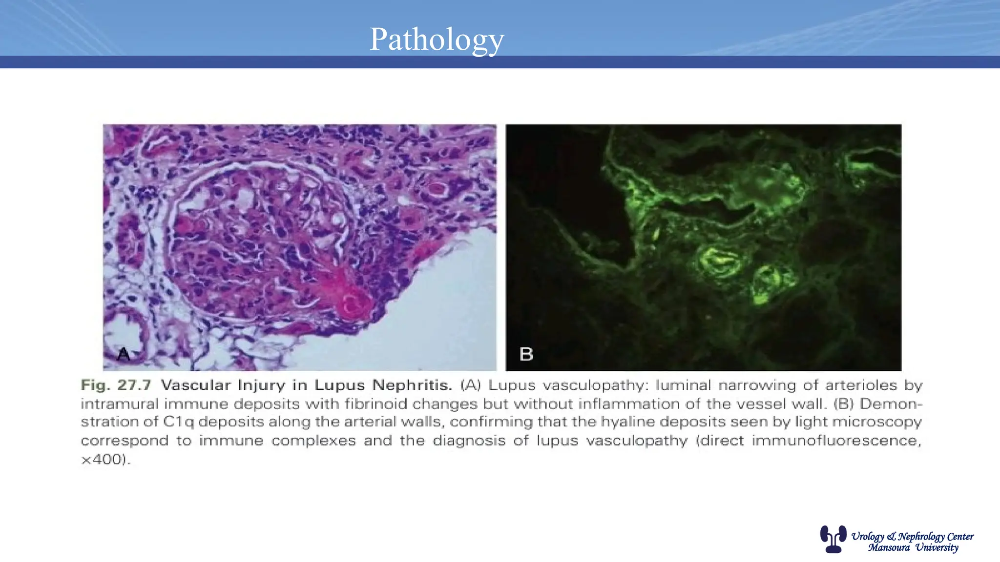 Urology & Nephrology Center
Mansoura University
Pathology
 