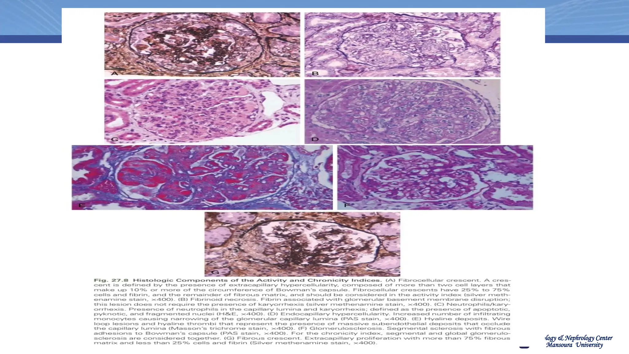 Urology & Nephrology Center
Mansoura University
Pathology
 