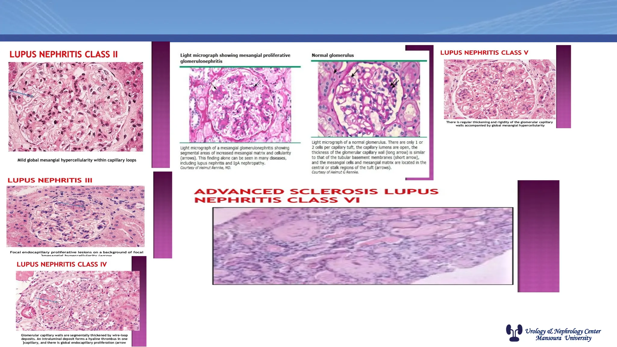 Urology & Nephrology Center
Mansoura University
 