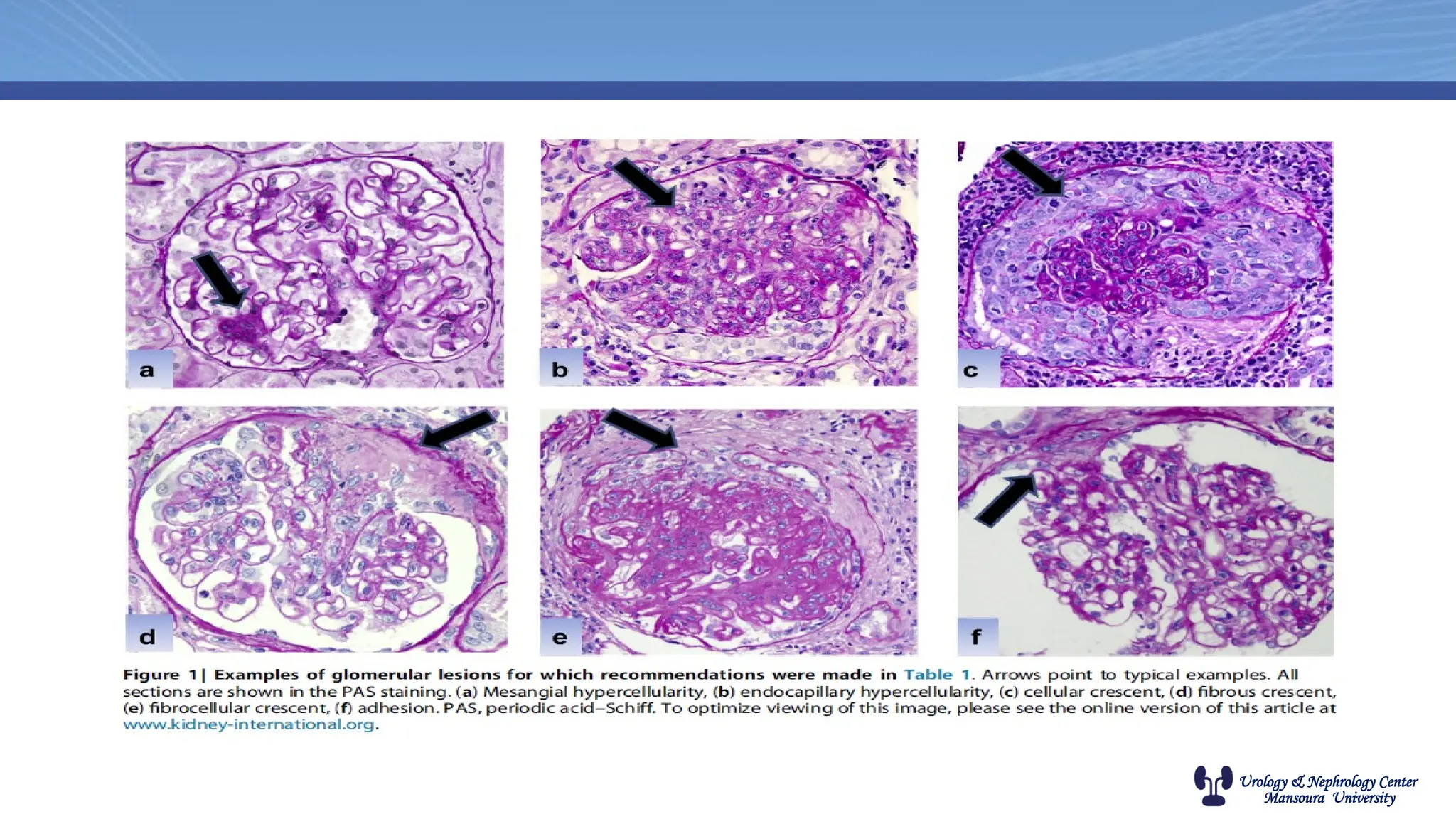 Urology & Nephrology Center
Mansoura University
 