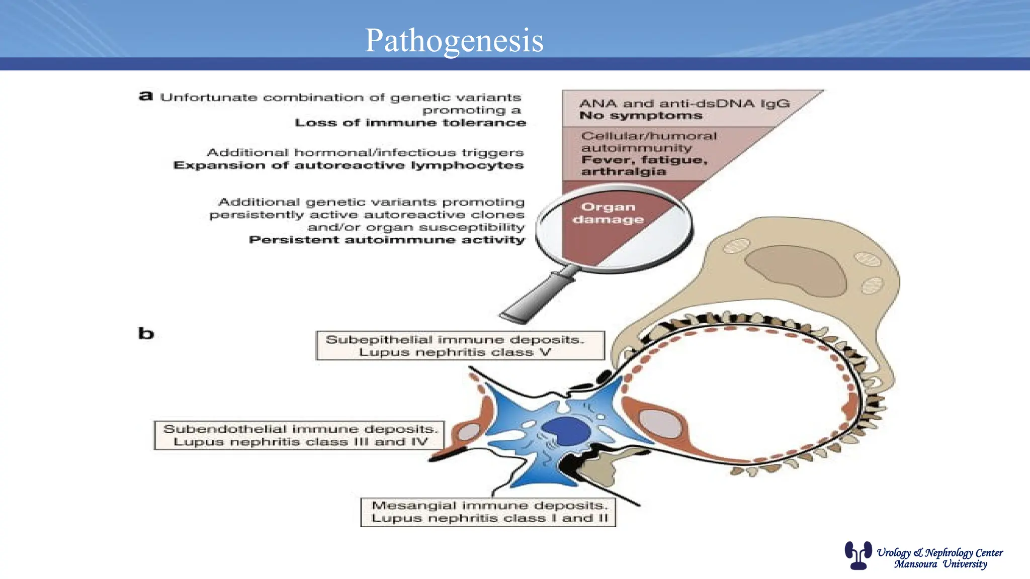 Urology & Nephrology Center
Mansoura University
Pathogenesis
 