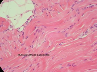 Músculo Estriado Esquelético