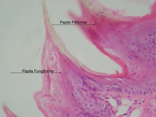 Papila Fungiforme Papila Filiforme