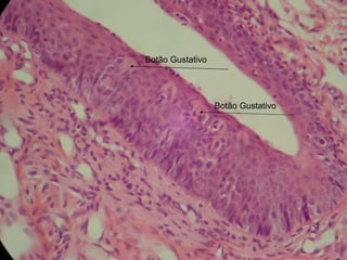 Botão Gustativo Botão Gustativo