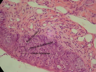 Botão Gustativo Célula de Sustentação Célula Gustatória