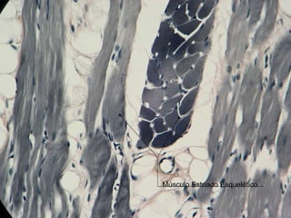 Músculo Estriado Esquelético