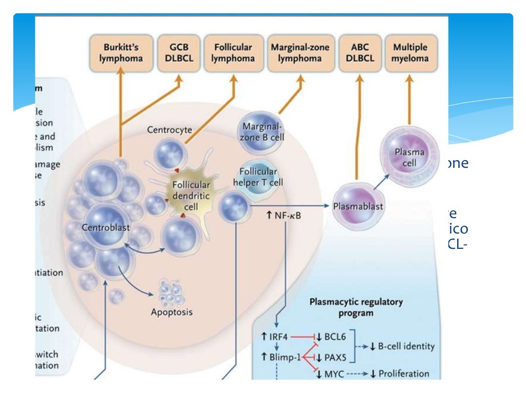 Linfoma No Hodgkin Células Grande B