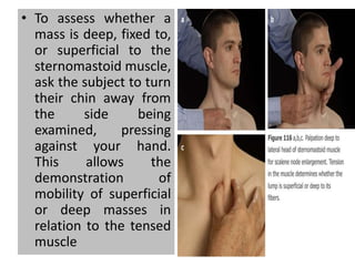 • To assess whether a
mass is deep, fixed to,
or superficial to the
sternomastoid muscle,
ask the subject to turn
their chin away from
the side being
examined, pressing
against your hand.
This allows the
demonstration of
mobility of superficial
or deep masses in
relation to the tensed
muscle
66
 