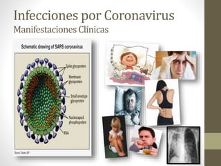 Infecciones por Coronavirus
ManifestacionesClínicas
 