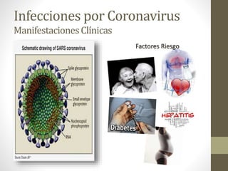 Infecciones por Coronavirus
ManifestacionesClínicas
Factores Riesgo
 