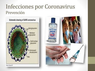 Infecciones por Coronavirus
Prevención
 