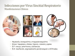 InfeccionesporVirus Sincitial Respiratorio
ManifestacionesClínicas
• Neumonía, bronquiolitis y traqueobronquiolitis
• Grave: taquipnea y disnea, hipoxia, cianosis y apnea.
• E.F: roncus, estertores y sibilancias.
• R.X: insuflación, engrosamiento perobronquial e infiltrados.
 