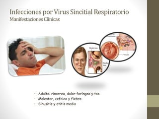InfeccionesporVirus Sincitial Respiratorio
ManifestacionesClínicas
• Adulto: rinorrea, dolor faríngeo y tos.
• Malestar, cefalea y fiebre.
• Sinusitis y otitis media
 