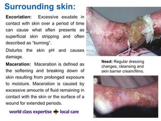 Surrounding skin:
Excoriation: Excessive exudate in
contact with skin over a period of time
can cause what often presents as
superficial skin stripping and often
described as “burning”.
Disturbs the skin pH and causes
damage.
Maceration: Maceration is defined as
the softening and breaking down of
skin resulting from prolonged exposure
to moisture. Maceration is caused by
excessive amounts of fluid remaining in
contact with the skin or the surface of a
wound for extended periods.
Need: Regular dressing
changes, cleansing and
skin barrier cream/films.
 