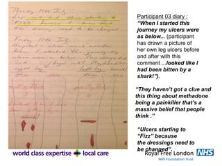 Participant 03 diary :
“When I started this
journey my ulcers were
as below... (participant
has drawn a picture of
her own leg ulcers before
and after with this
comment ...looked like I
had been bitten by a
shark!”).
“Ulcers starting to
“Fizz” because
the dressings need to
be changed”.
“They haven’t got a clue and
this thing about methadone
being a painkiller that’s a
massive belief that people
think .”
 