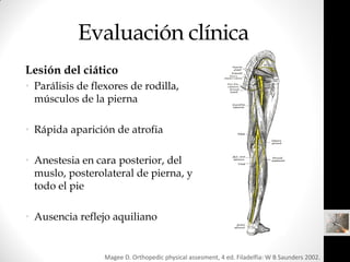 Evaluación clínica
Lesión del ciático
• Parálisis de flexores de rodilla,
  músculos de la pierna

• Rápida aparición de a...