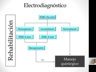 Electrodiagnóstico
                                   EMG 3ra sem
Rehabilitación

                 Neuropraxia       Axono...