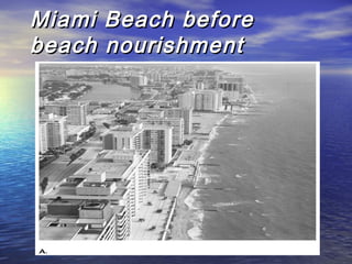 Miami Beach beforeMiami Beach before
beach nourishmentbeach nourishment
 