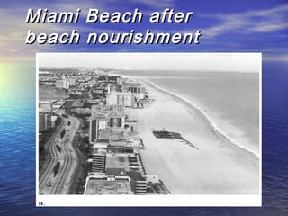 Miami Beach afterMiami Beach after
beach nourishmentbeach nourishment
 