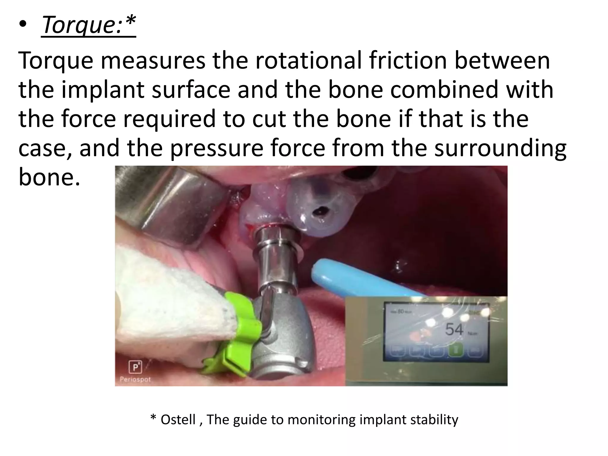 • Torque:*
Torque measures the rotational friction between
the implant surface and the bone combined with
the force required to cut the bone if that is the
case, and the pressure force from the surrounding
bone.
* Ostell , The guide to monitoring implant stability
 