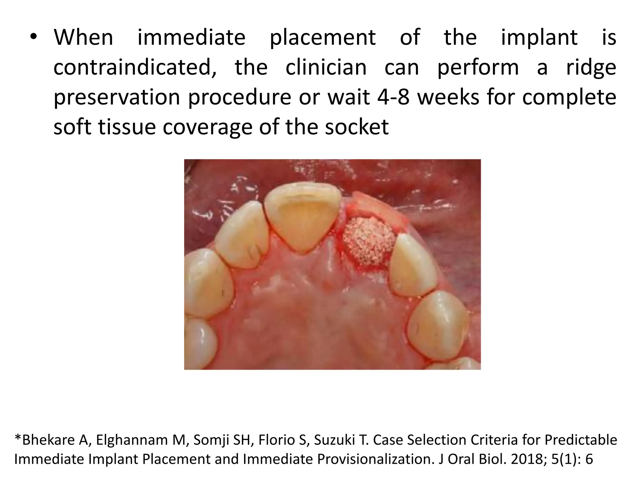 • When immediate placement of the implant is
contraindicated, the clinician can perform a ridge
preservation procedure or wait 4-8 weeks for complete
soft tissue coverage of the socket
*Bhekare A, Elghannam M, Somji SH, Florio S, Suzuki T. Case Selection Criteria for Predictable
Immediate Implant Placement and Immediate Provisionalization. J Oral Biol. 2018; 5(1): 6
 
