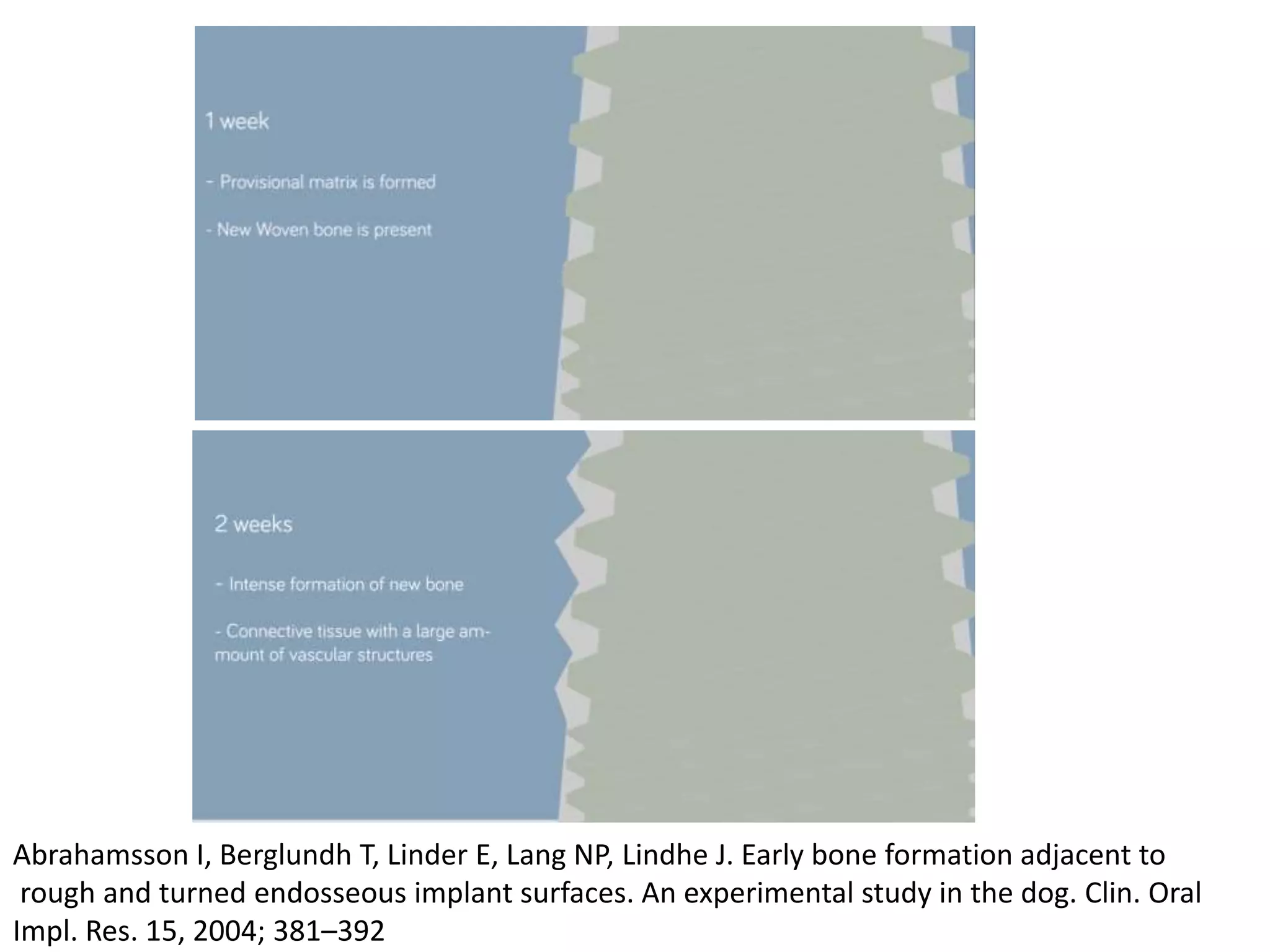 Abrahamsson I, Berglundh T, Linder E, Lang NP, Lindhe J. Early bone formation adjacent to
rough and turned endosseous implant surfaces. An experimental study in the dog. Clin. Oral
Impl. Res. 15, 2004; 381–392
 